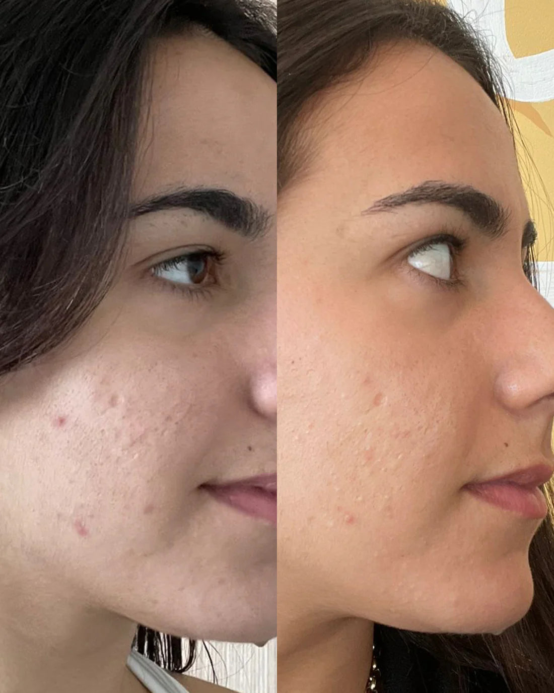 AquaBoost™ - Agua Pura para Tu Belleza