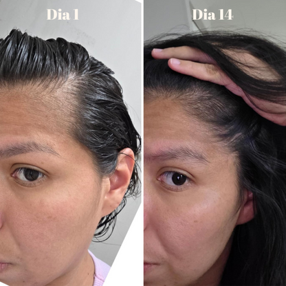 AquaBoost™ - Agua Pura para Tu Belleza